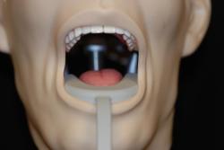 ClearView SCAN tray in place